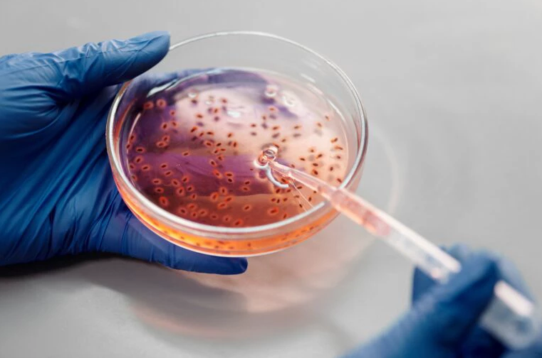 Vírus de Marburg, um dos mais letais, tem surto confirmado