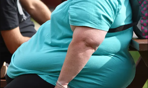 Médicos querem proibir uso do termo ‘obesidade’
