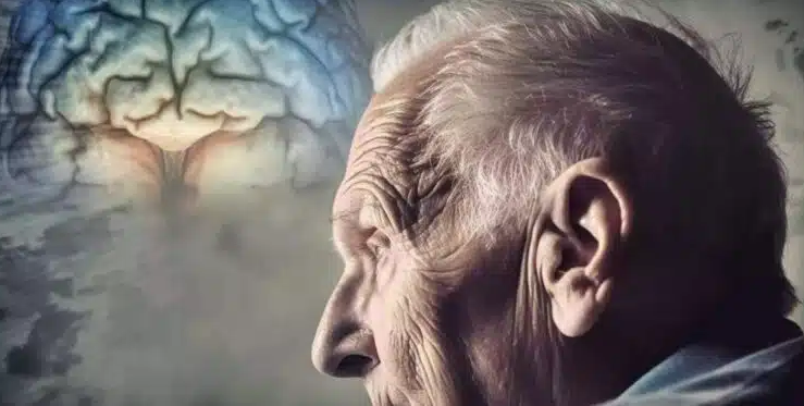 Conheça os dois sinais que podem indicar doença de Alzheimer
