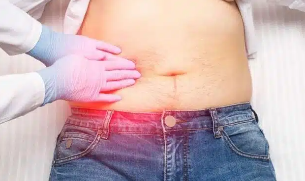 Conheça 6 sintomas que podem indicar pedra na vesícula