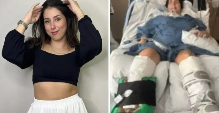 Botulismo: conheça a doença que provocou a paralisia de uma brasileira de 23 anos nos EUA