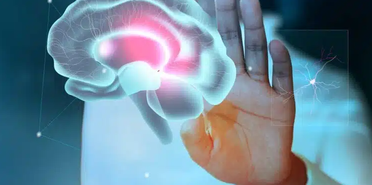 Veja os fatores que aumentam o risco de você sofrer um AVC antes dos 45 anos